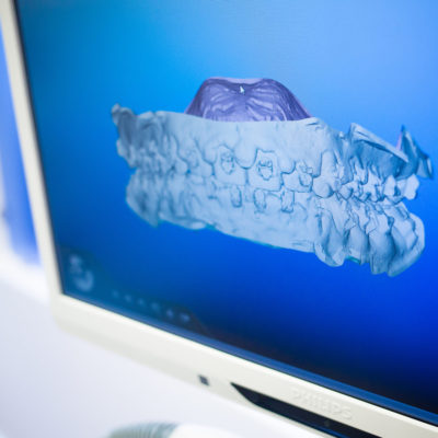 Innovative-Orthodontics-South-New-Jersey-iortho.com-205-400x400 Empower Braces  