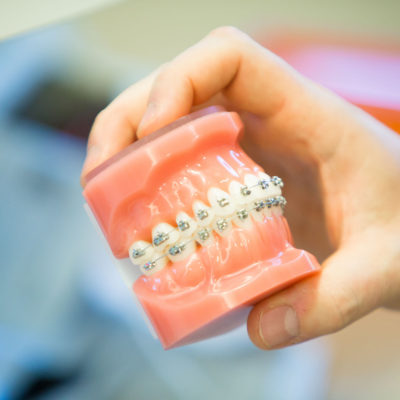 Innovative-Orthodontics-South-New-Jersey-iortho.com-222-400x400 Empower Braces  