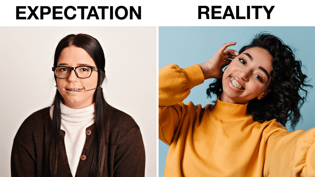 braces-expectation-reality-south-jersey-1024x575 Braces: Expectation vs. Reality